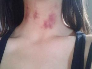 Mulher casada sai para fazer caminhada, volta toda chupada e diz que foi “Gafanhoto Tarado”.