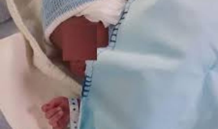 Bebê sofre corte na orelha durante o parto e mãe é vítima de gordofobia