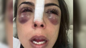 Imagens fortes: Polícia Civil investiga agressão de três homens contra arquiteta no Rio de Janeiro