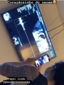 Whindersson e Maria Lina mostram ultrassom do filho: 