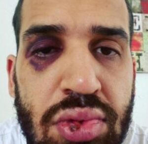 Revolta: Médico é agredido por familiar após alertar sobre riscos da Covid-19