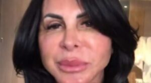 Gretchen faz novo procedimento estético no rosto e internautas a comparam com