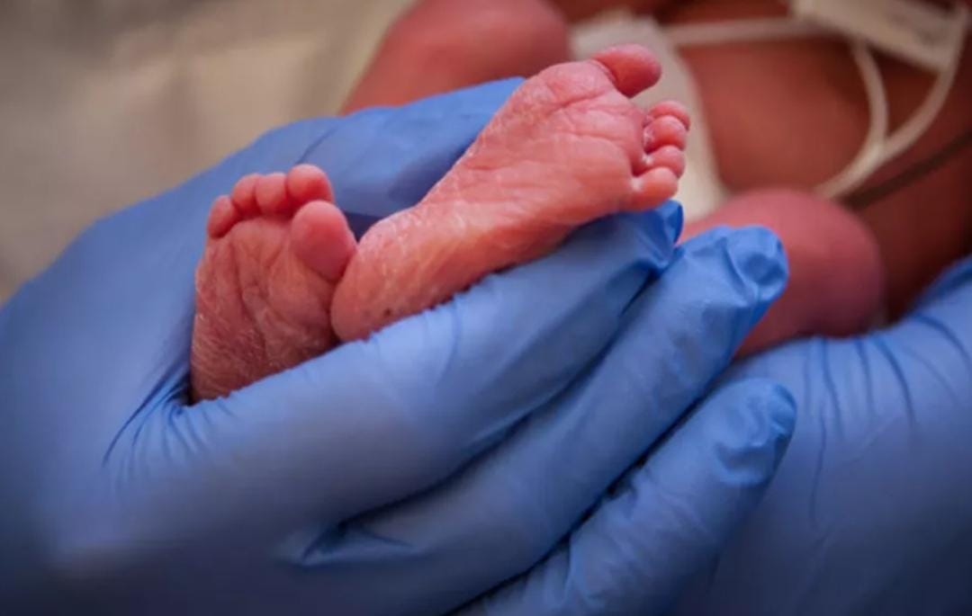 Vídeo: Bebê de 2 meses é levado às pressas ao hospital e médicos ficam assustados ao saber o que ele tem: “Alerta”