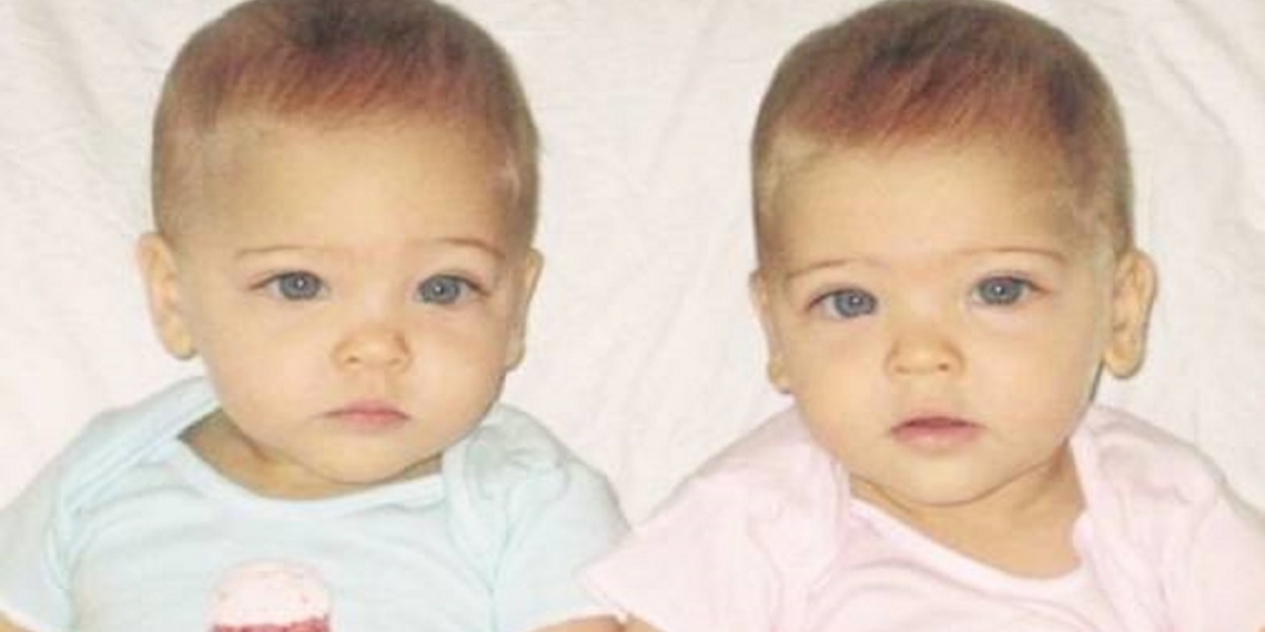 Lembra delas? As gêmeas mais bonitas do mundo cresceram e estão deslumbrantes de lindas, confira!