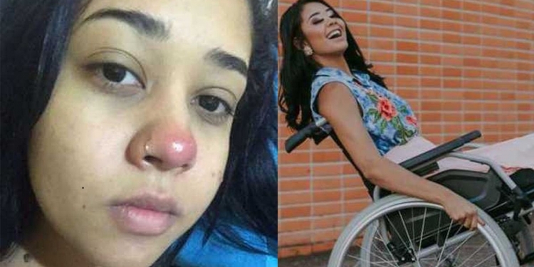 Chocante: Jovem ficou paraplégica depois ter colocado um piercing no nariz, confira!