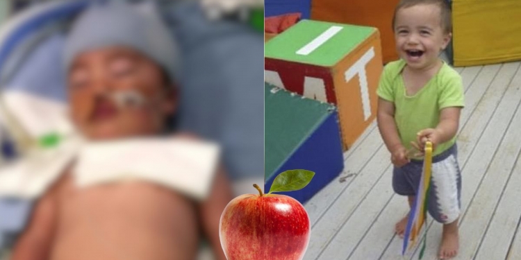 Veja o vídeo! Pais fazem alerta depois do filho sofrer paralisia cerebral na creche após comer uma maçã