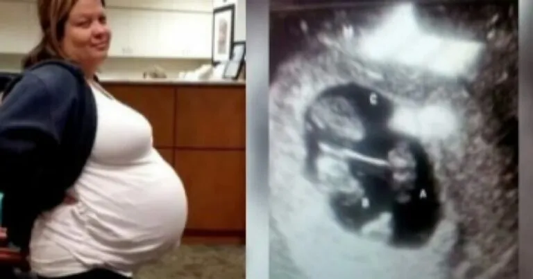 Mulher engravida após médicos dizerem que seria impossível, mas quando eles vêem o ultrassom, a sala inteira se assusta!