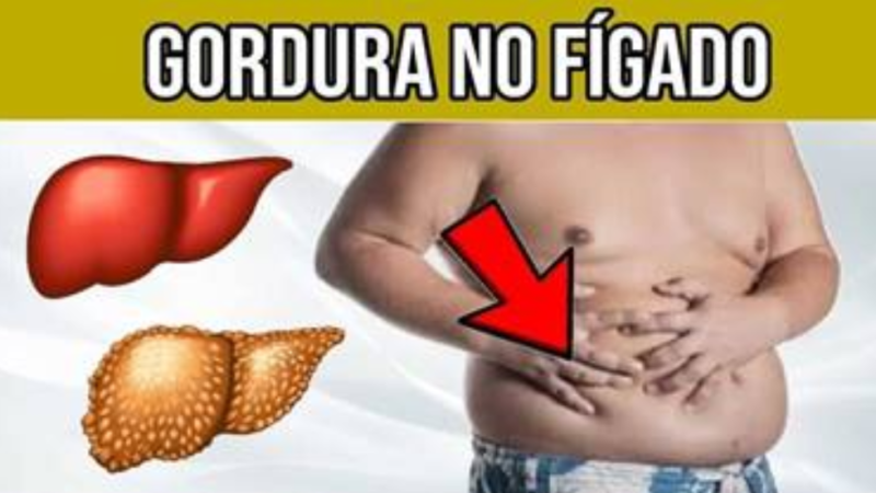 Gordura no fígado – O que causa a esteatose hepática!!!
