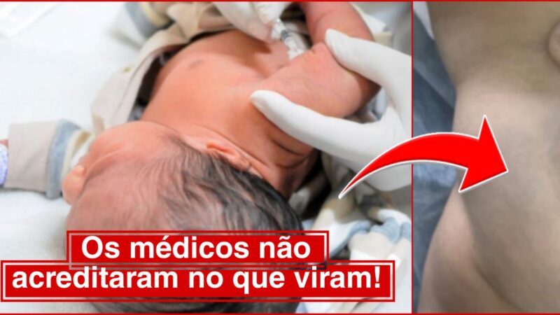 Menina do interior de São Paulo assusta médicos ao nascer com anomalia rara; ‘Ela tinha uma enorme ca… Ver mais