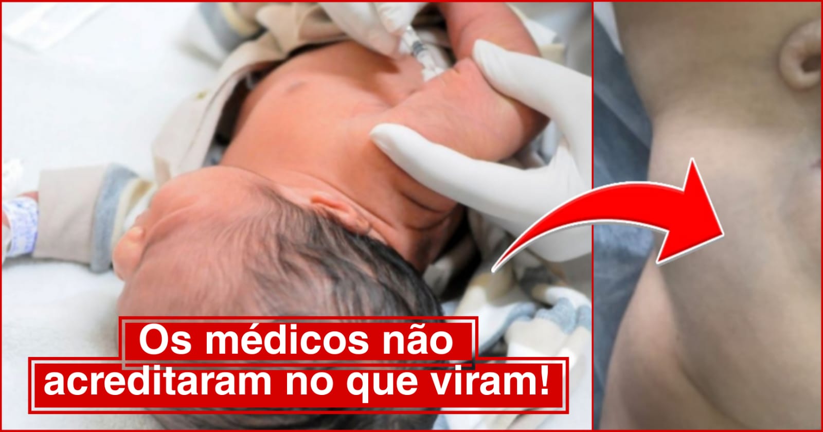 Foto do bebê. A anomalia rara assustou os médicos. Imagem: internet.
