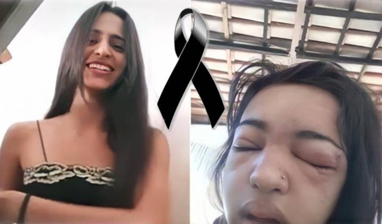 No último domingo, uma adolescente de 15 anos faleceu após ter colocado um piercing na sobrancelha de forma caseira, com a ajuda de uma amiga. FOTO: internet.