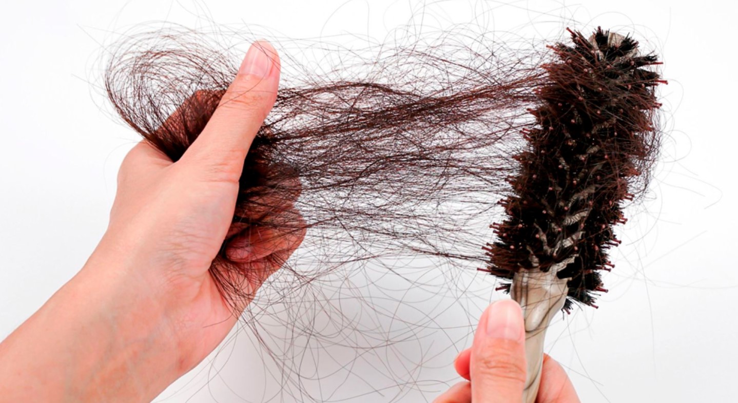 Cabelo caindo? A queda de cabelo é um problema comum que afeta muitas pessoas em todo o mundo. Saiba o que pode ser! FOTO: internet.