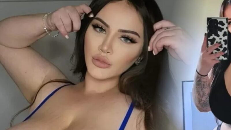 Mulher que tem condição rara ficou com seios gigantes e usou isto para faturar mais de R$ 1,5 milhão