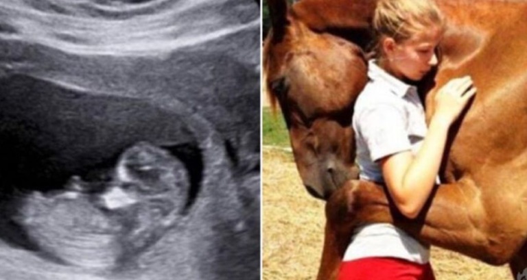 Cavalo abraça mulher grávida e quando a família vai ao médico e checa seu ultrassom, médico liga para a polícia