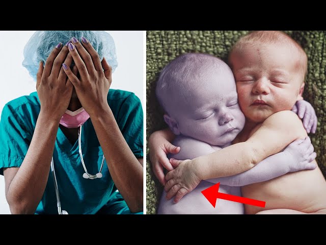 Enfermeira Coloca Bebê Saudável ao Lado de Sua Gêmea sem Vida