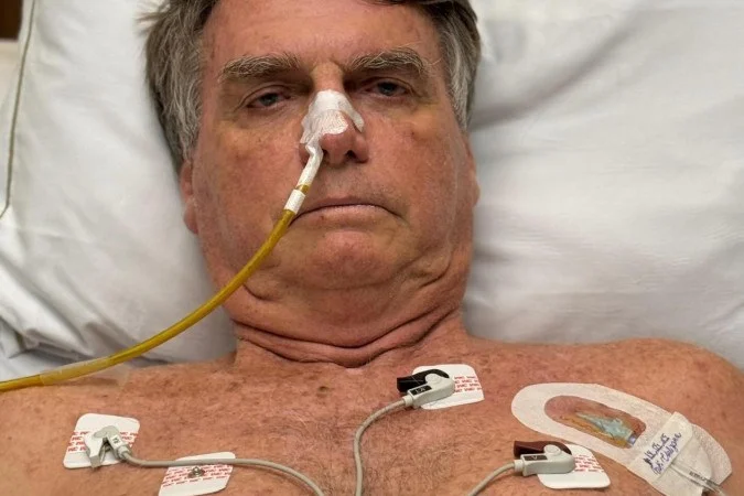 HOSPITAL Divulga Real Estado de Saúde de BOLSONARO em Boletim Médico
