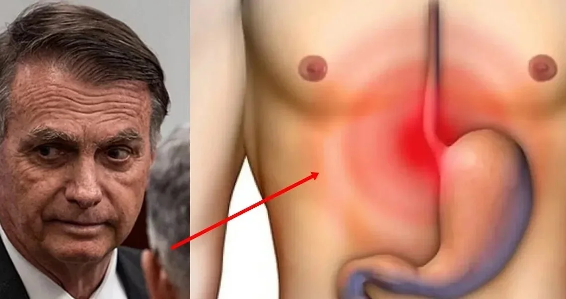 Jair Bolsonaro enfrenta nova crise de saúde com soluços e vômitos, relata Carlos Bolsonaro