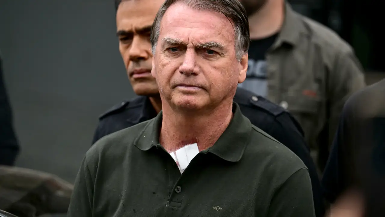 Jair Bolsonaro realiza cirurgia em Brasília durante prisão domiciliar após condenação pelo STF